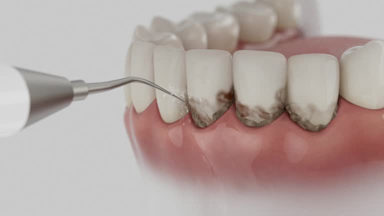 Reliable Dental contractor in Potosi, MO by Dentist Open Now